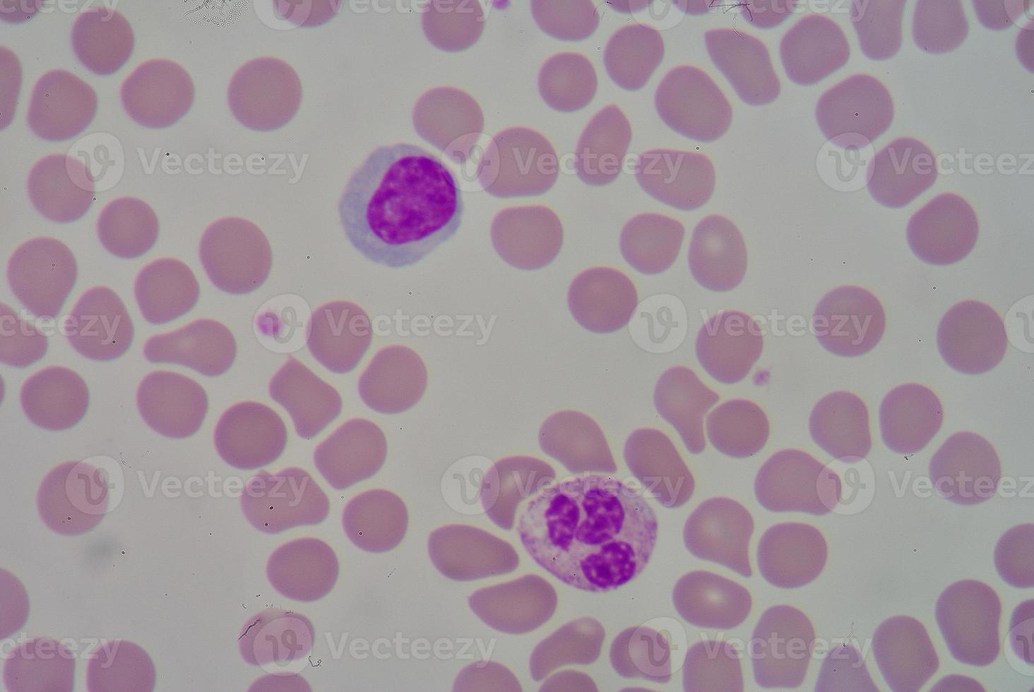 neutrophiles et lymphocytes photo