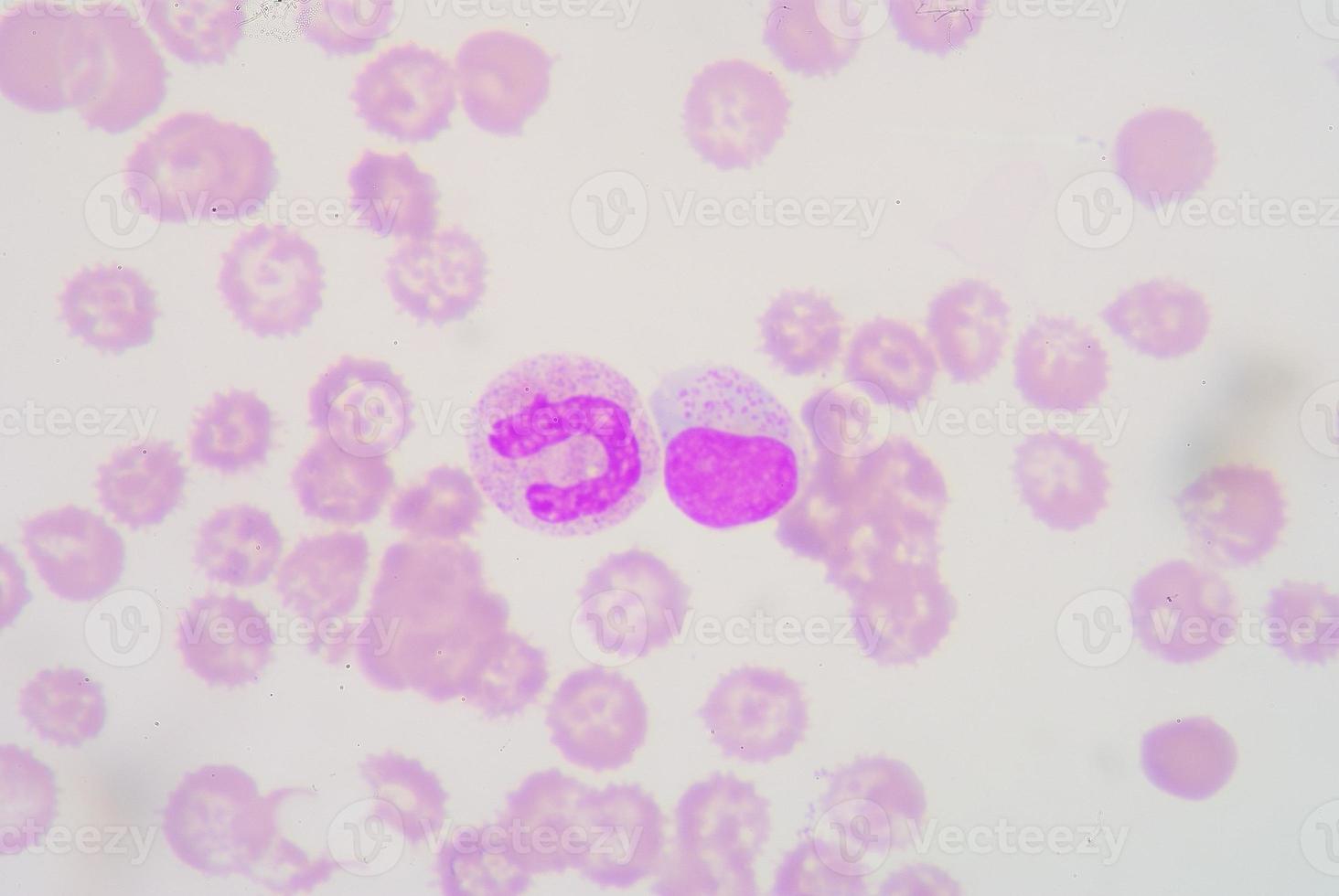 lymphocytes et bandes neutrophiles photo