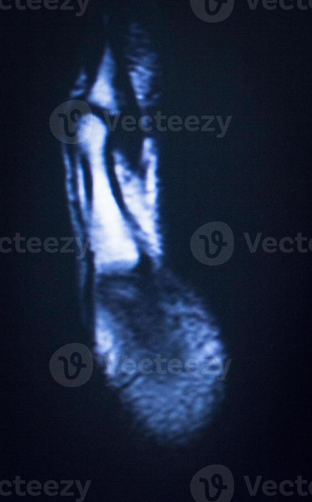 imagerie par résonance magnétique IRM photo