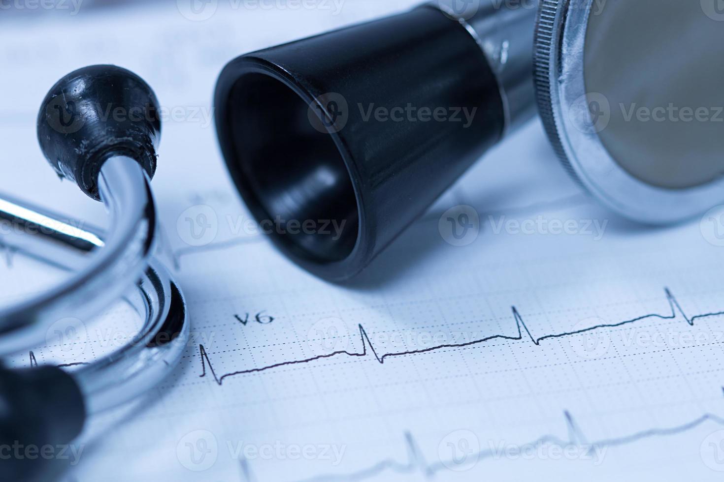stéthoscope et électrocardiogramme photo