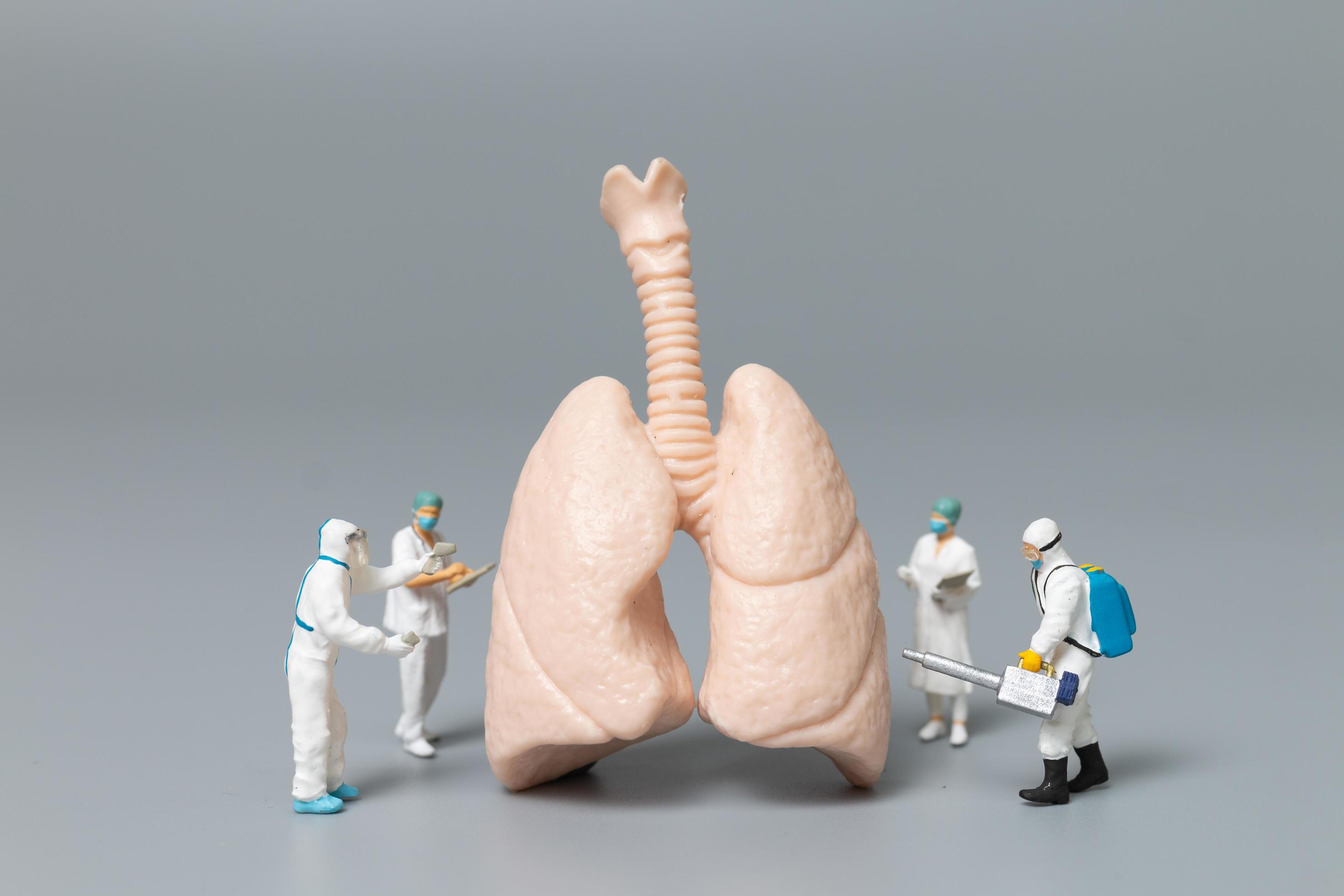 médecins et infirmières miniatures observant et discutant du concept infecté par les poumons, les virus et les bactéries photo