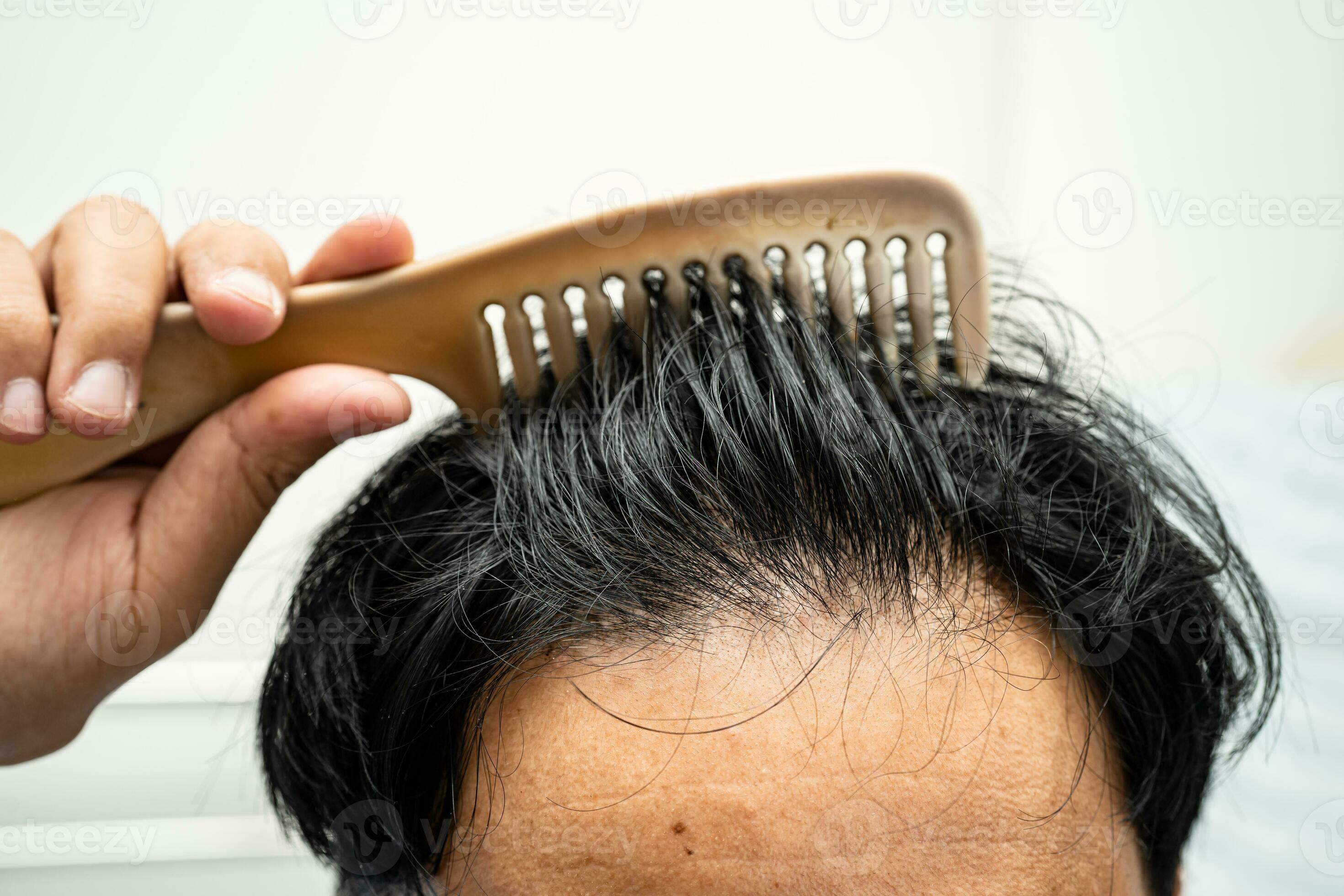 https://static.vecteezy.com/ti/photos-gratuite/p2/26495586-chauve-a-de-face-de-tete-et-commencer-non-perte-cheveux-glabre-de-mature-asiatique-affaires-intelligent-actif-bureau-homme-photo.jpg