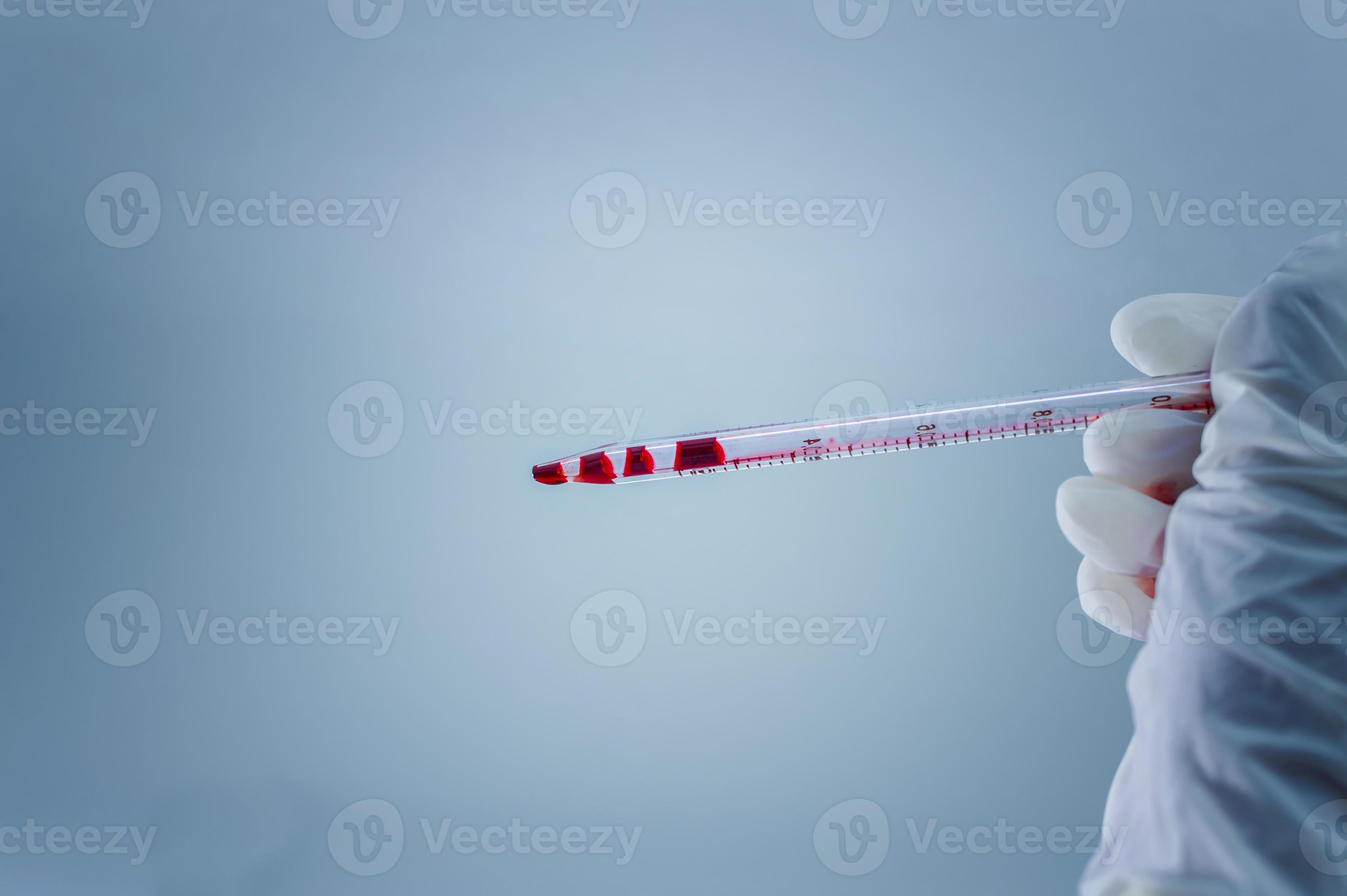 laboratoire médical. pipette avec du sang dans la main dans un gant médical  sur fond bleu. le concept de recherche en laboratoire. 4791784 Photo de  stock chez Vecteezy