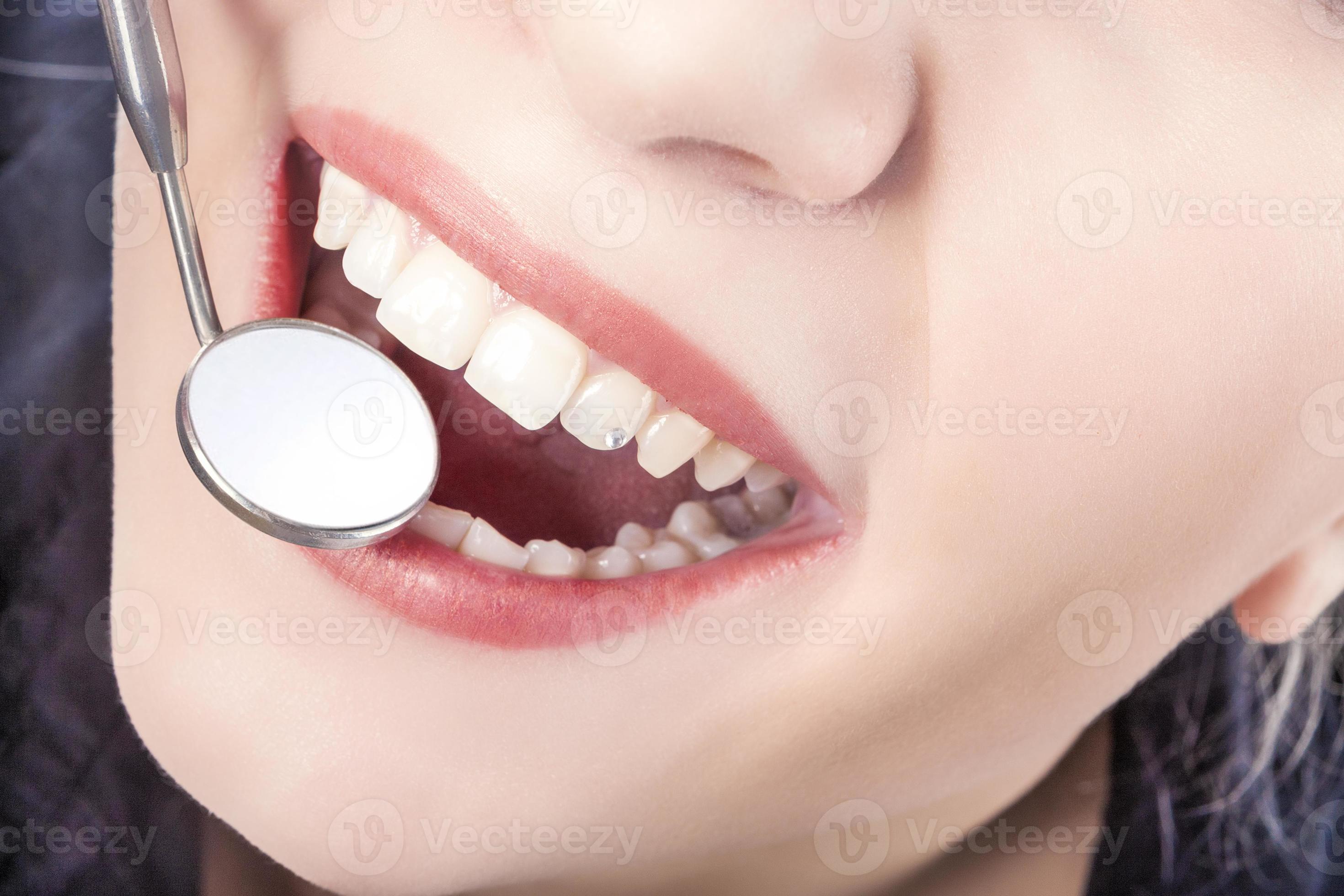 traitement dentaire, à, bouche, miroir, de, jeune, caucasien, femme 880150  Photo de stock chez Vecteezy
