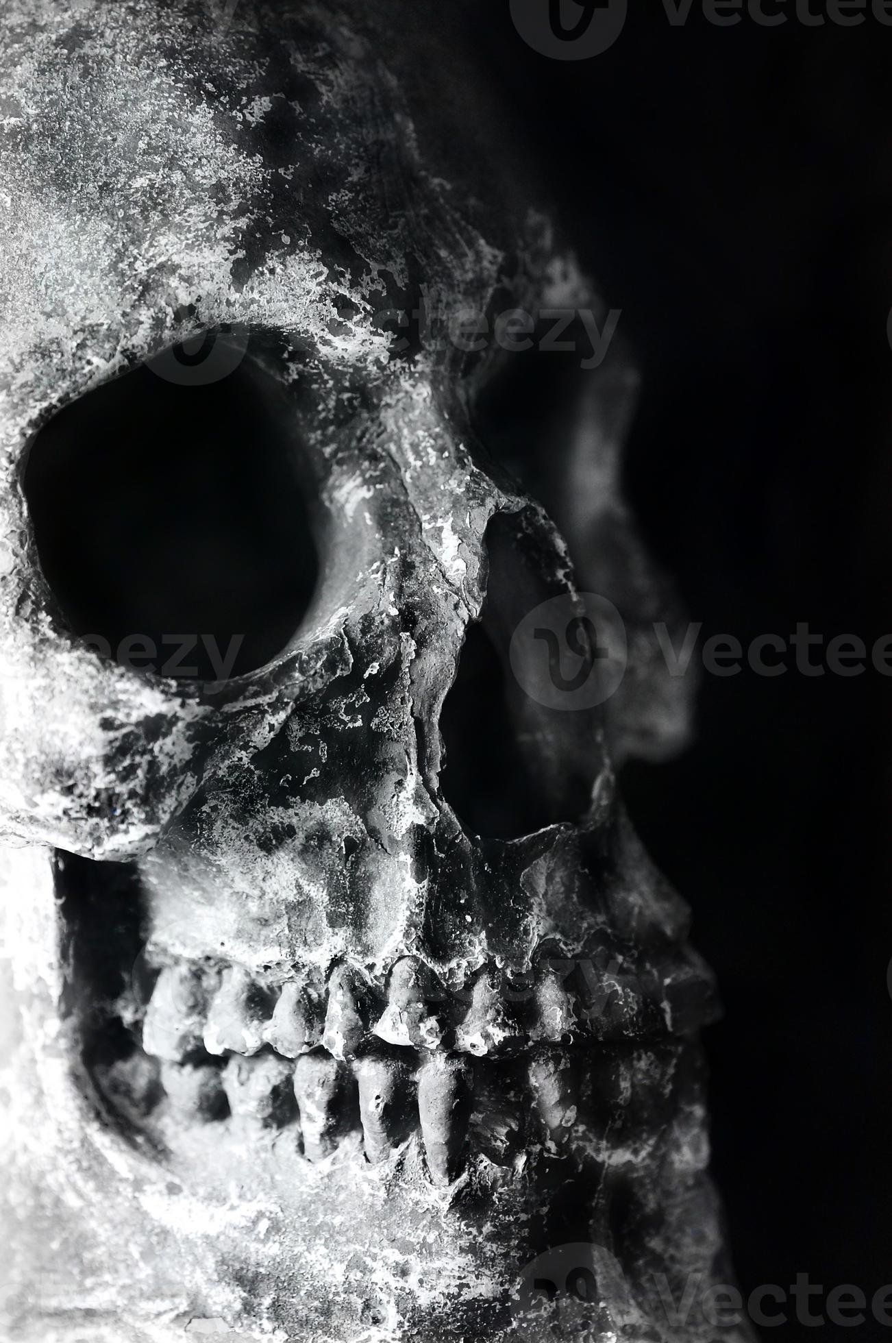 gros plan du crâne humain fissuré et endommagé photo