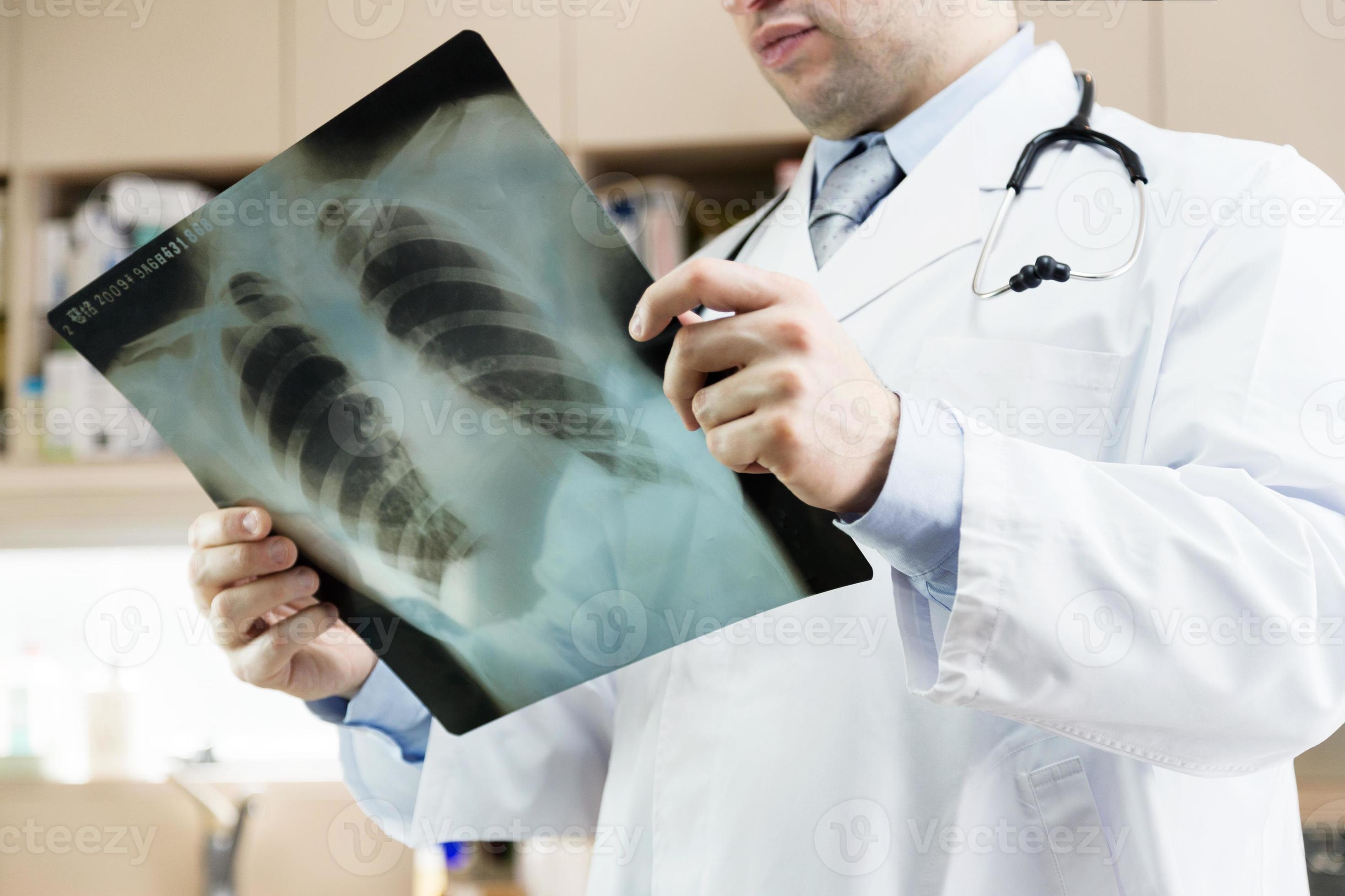 médecin montrant une radiographie des poumons. hôpital. contrôle médical. photo