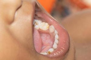 bébé sourire proche. dents blanches d'un enfant isolé photo