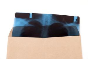 film radiographique de la poitrine dans une enveloppe brune isolée photo