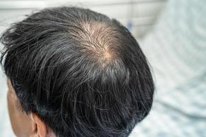 chauve au milieu de la tête et ne commence pas à perdre les cheveux glabres d'un homme de bureau actif et intelligent d'affaires asiatiques matures. photo