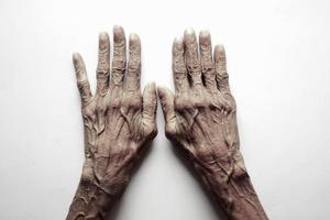 gros plan des mains d'une personne âgée photo