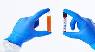 coronavirus, médecin tenant un tube d'échantillon de sang de virus covid-19 positif fond blanc photo