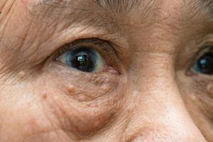 visage et yeux de femme âgée asiatique avec rides, vue rapprochée du portrait. photo