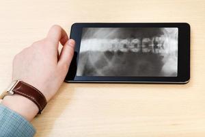 scientifique analyse la colonne vertébrale sur tablet pc photo