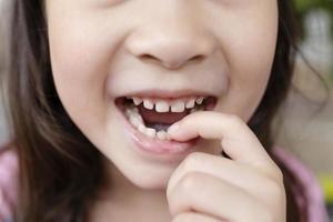 dents de bébé dans la bouche d'une fillette de 6 à 7 ans, il la balance avec son doigt, vue rapprochée de la bouche ouverte. perte de dents par concept d'âge. remplacement des dents permanentes. photo