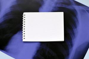 image de film radiographique de la poitrine humaine pour un diagnostic médical et une page de bloc-notes vierge vide sur une table d'hôpital bleue. vue de dessus à plat photo