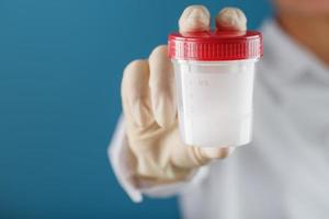 la main gantée d'un médecin tenant une bouteille d'un récipient avec un échantillon de sperme pour analyse médicale. photo