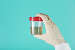 la main gantée du médecin tient un récipient transparent avec un test d'urine. photo