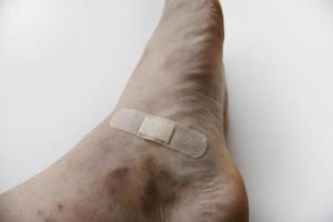 une tache sur la jambe blanche d'un homme. le patch sur la blessure à la jambe est un gros plan. photo