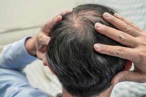 chauve au milieu de la tête et ne commence pas à perdre les cheveux glabres d'un homme de bureau actif et intelligent d'affaires asiatiques matures. photo