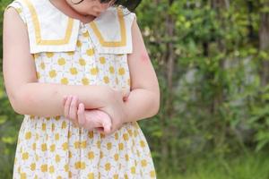 petite fille a une allergie cutanée qui démange et se gratte le bras photo