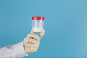 sperme dans un bocal pour analyse dans la main du médecin sur fond bleu. photo
