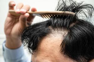 chauve au milieu de la tête et ne commence pas à perdre les cheveux glabres d'un homme de bureau actif et intelligent d'affaires asiatiques matures. photo