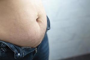 une femme obèse a besoin de contrôler son poids, elle a un excès de graisse. photo