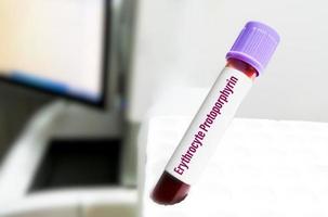 tube d'échantillon de sang pour le test de protoporphyrine érythrocytaire, diagnostic de la maladie de l'anémie photo