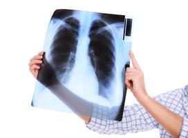 mains tenant une radiographie des poumons photo