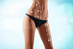 adapter le corps féminin avec les flèches de dessin. chirurgie plastique, alimentation saine, liposuccion, sport et concept d'élimination de la cellulite. photo