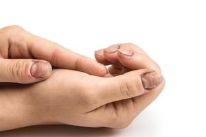 mains féminines avec des ongles sales sur fond gris photo