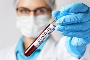 femme médecin tient un échantillon de sang du covid-19 photo