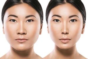 transformation de la femme asiatique. résultat de la chirurgie plastique. photo