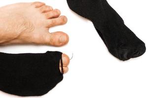 gros plan de pieds mâles avec des orteils qui sortent de la chaussette hoaly. photo