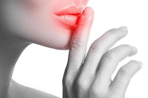 lèvre affectée par un herpès simplex ou d'autres problèmes photo