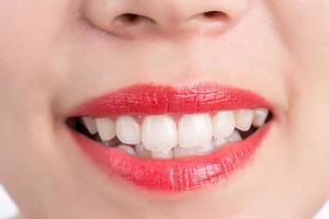 gros plan sur une bouche souriante lèvres roses photo
