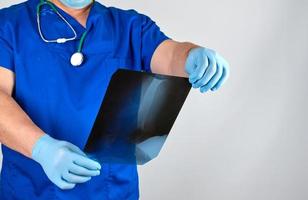 un médecin en uniforme bleu et des gants en latex stériles tiennent et examinent la radiographie de l'os de la jambe photo