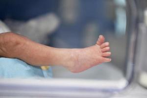 peu pied de une nouveau née bébé. néonatale médicament. photo