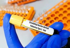du sang échantillon pour cvdpv2 ou circulé dérivé du vaccin poliovirus type 2 test. photo
