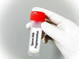 scientifique en portant échantillon récipient avec sperme pour ADN fragmentation test.