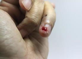 saignement blessure sur doigt à la gauche main avec blanc arrière-plan, saignement sur peu doigt, doux et floue concentrer photo