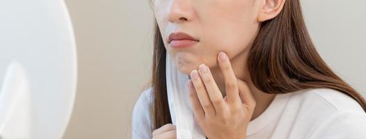 dermatologie, la puberté asiatique Jeune femme, fille à la recherche dans miroir, allergie lorsque porter masque et cosmétique, spectacle pressant bouton place pour enlever de visage.beauté se soucier de peau problème par acné traitement photo