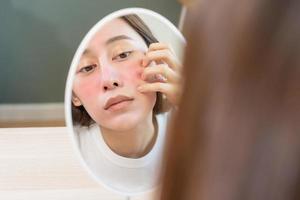 dermatologie, la puberté asiatique Jeune femme, fille à la recherche dans miroir, allergie en présentant un allergique réaction de cosmétique, rouge place ou téméraire sur affronter. beauté se soucier de peau problème par médical traitement. photo