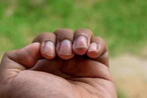 proche en haut de longue doigt ongles avoir besoin à être coupé. en bonne santé et corps se soucier concept photo