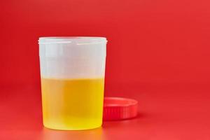 analyse d'urine pour lithiase urinaire en récipient photo