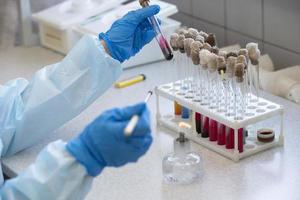 le mains de une médecin laboratoire assistant dans un infectieux maladie laboratoire examine le échantillons. photo