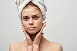 jolie femme avec une bouton sur le visage cosmétologie studio photo