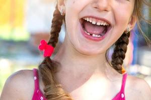 édenté content sourire de une fille avec une déchue inférieur Lait dent fermer. en changeant les dents à molaires dans enfance photo