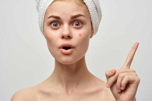 magnifique femme avec une bouton sur le visage dermatologie isolé Contexte photo