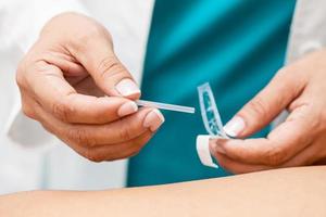 médecin performant acupuncture sur une Jeune Masculin patient photo